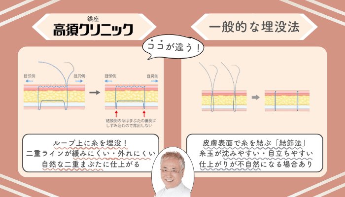 銀座高須クリニック二重埋没法一般的な施術法との違い