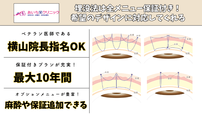 あいち栄クリニック二重比較