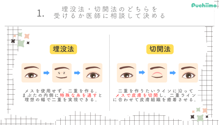 二重整形仙台選び方1