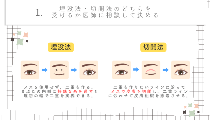 二重整形名古屋・栄選び方1