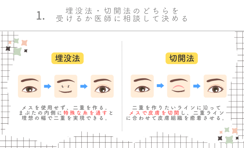 二重整形銀座選び方1