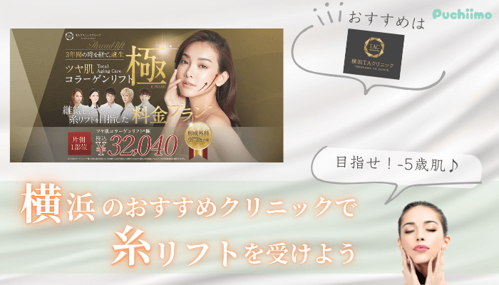 糸リフト比較横浜まとめ