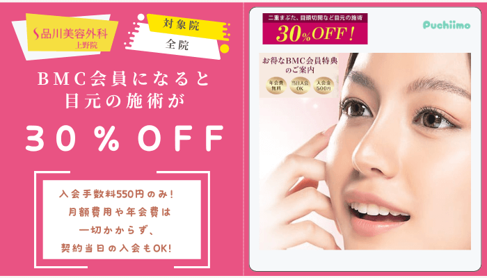 品川美容外科上野二重BMC会員になると目元の施術が30％OFF