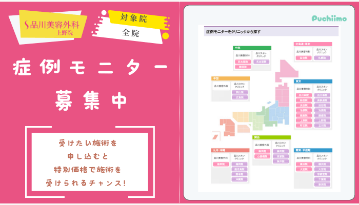 品川美容外科上野二重症例モニター募集中