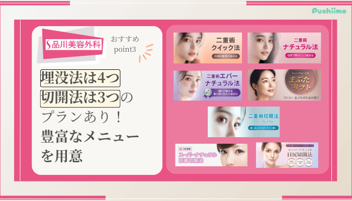品川美容外科二重整形おすすめポイント3