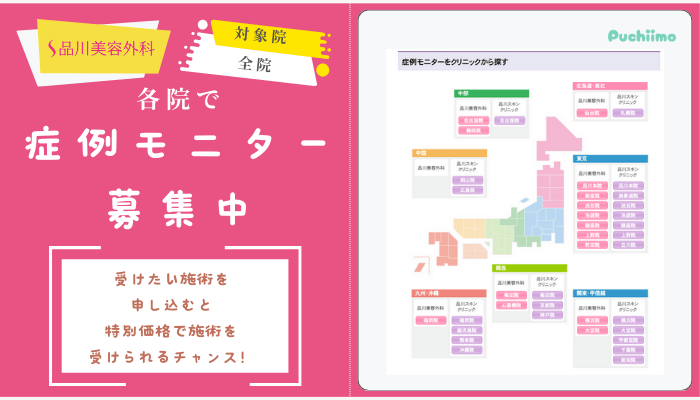 品川美容外科各院で症例モニター募集中