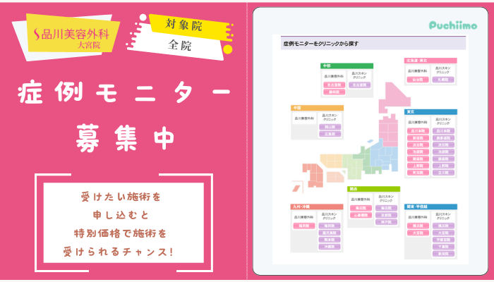 品川美容外科大宮二重症例モニター募集中