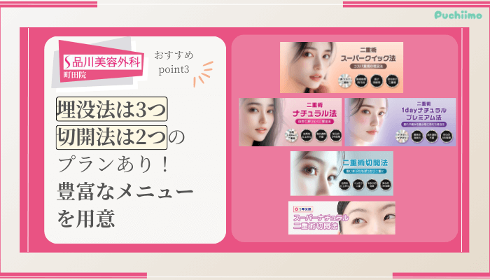 https://puchi-mo.jp/wp-content/uploads/2024/08/品川美容外科町田二重整形おすすめポイント3