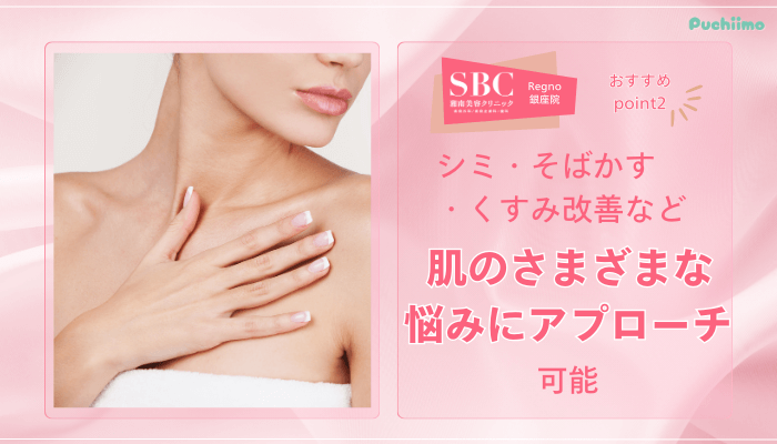 SBCRegno銀座フォトRFおすすめポイント2