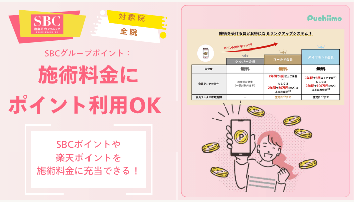 SBCフォトRFSBCグループポイントを施術料金に利用できる