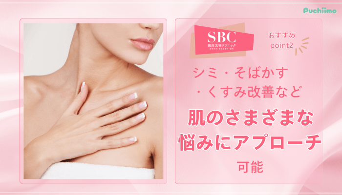 SBCフォトRFおすすめポイント2