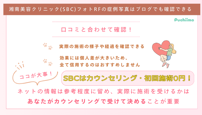 SBCフォトRF症例写真