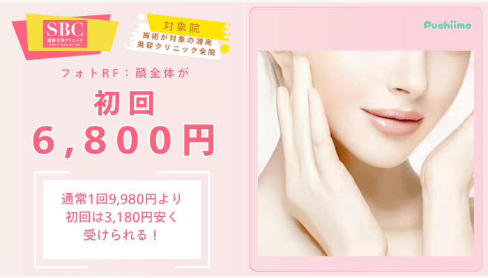 SBCフォトRF：顔全体が初回6800円