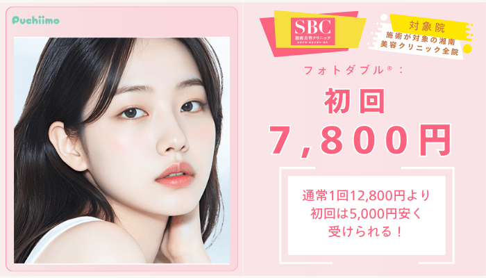 SBCフォトダブル®：初回7800円度
