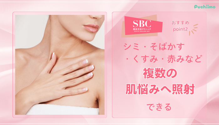 SBCフォトフェイシャルおすすめポイント2