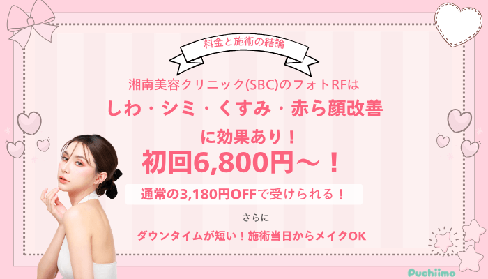 SBCフォトフェイシャル料金と施術の結論