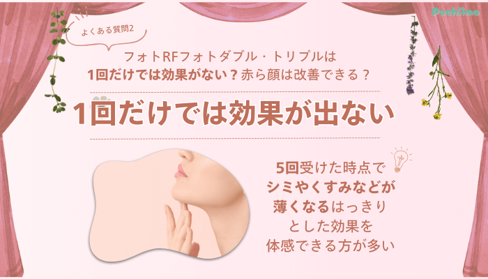 SBC六本木フォトRFよくある質問2