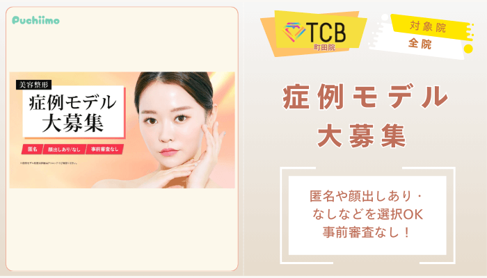 TCB町田ピコレーザー美容整形症例モデル大募集