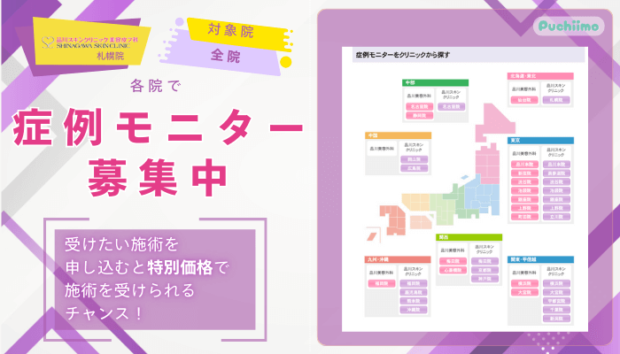 品川スキンクリニック札幌レーザートーニング各院で症例モニター募集中