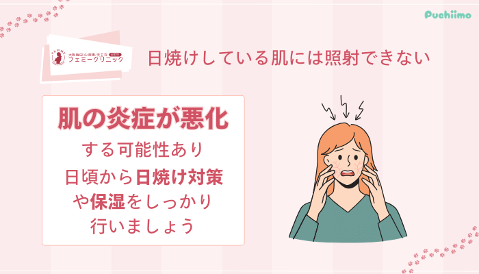 大阪梅田フェミークリニックレーザートーニング日焼けしている肌には照射できない