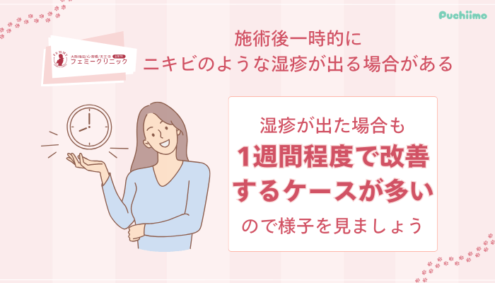 心斎橋フェミークリニックレーザートーニング施術後一時的にニキビのような湿疹が出る場合がある