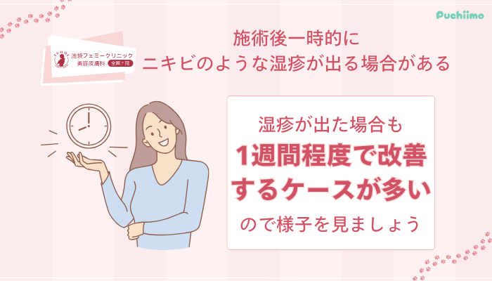 池袋フェミークリニックレーザートーニング施術後一時的にニキビのような湿疹が出る場合がある