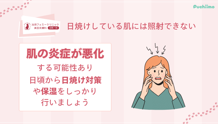 池袋フェミークリニックレーザートーニング日焼けしている肌には照射できない