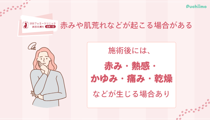 渋谷フェミークリニックレーザートーニングデメリット・リスク1