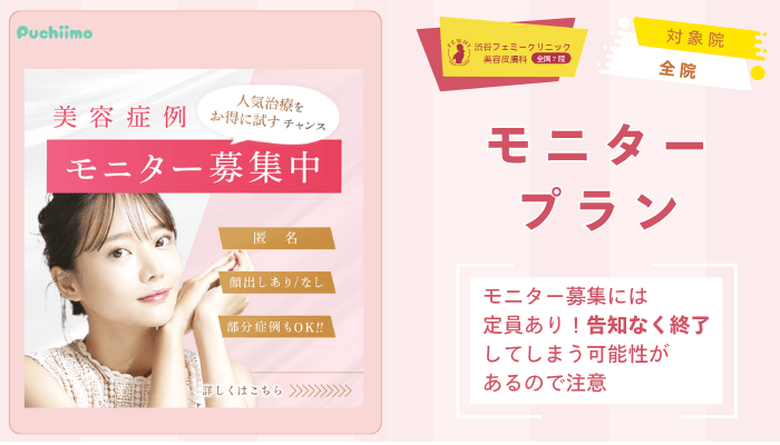 渋谷フェミークリニックレーザートーニングモニタープラン