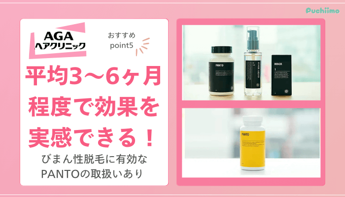 AGAヘアクリニックFAGAおすすめポイント5