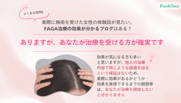 AGAヘアクリニックFAGAよくある質問8