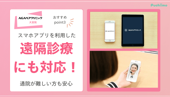 AGAヘアクリニック大宮FAGAおすすめポイント3