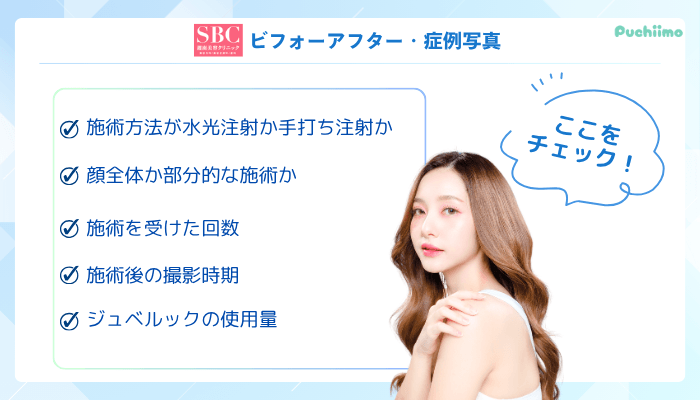 SBC水光注射ビフォーアフター・症例写真