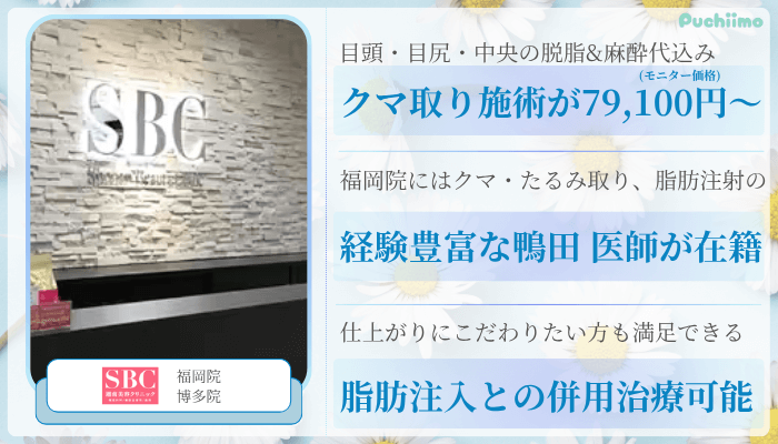 SBC福岡クマ取り比較