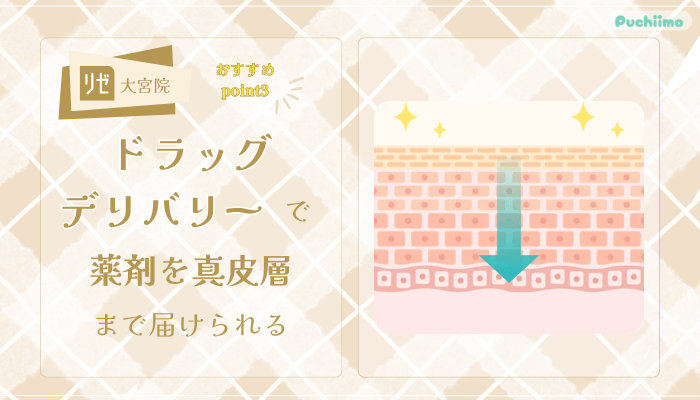 リゼクリニック大宮ポテンツァおすすめポイント3