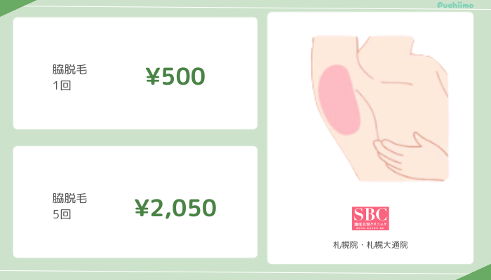 医療脱毛札幌SBC脇脱毛料金