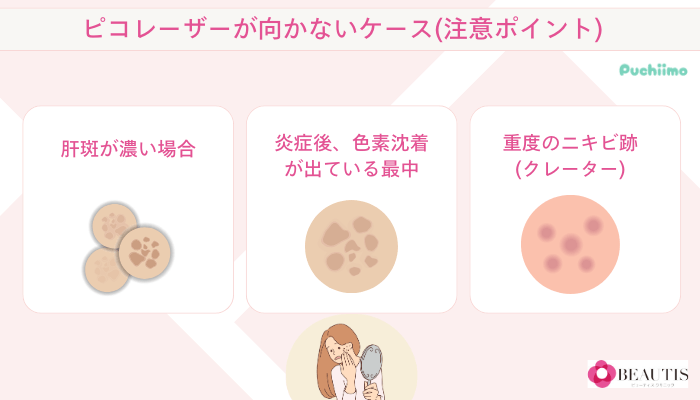 ビューティスクリニックのピコレーザーが向かないケース