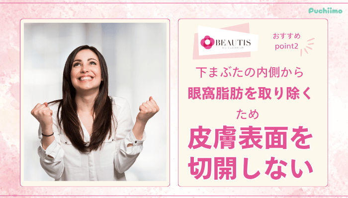 ビューティスクリニッククマ取りおすすめポイント2