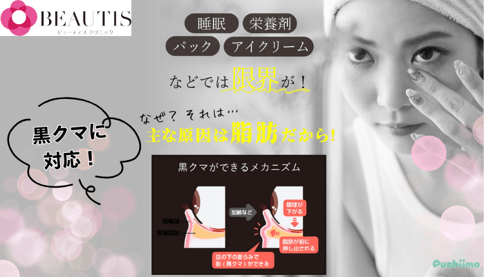 ビューティスクリニッククマ取り対応できるクマの種類