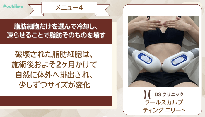 DSクリニック医療ダイエットクールスカルプティング-エリート