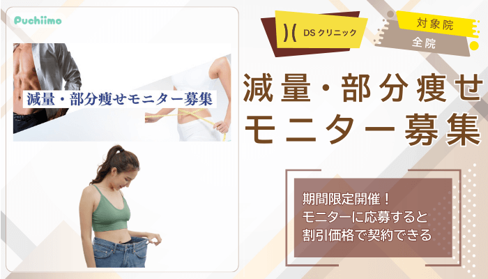 DSクリニック医療ダイエット減量・部分痩せモニター募集