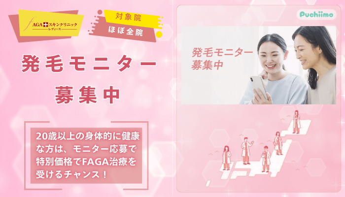 AGAスキンクリニックFAGA発毛モニター募集中