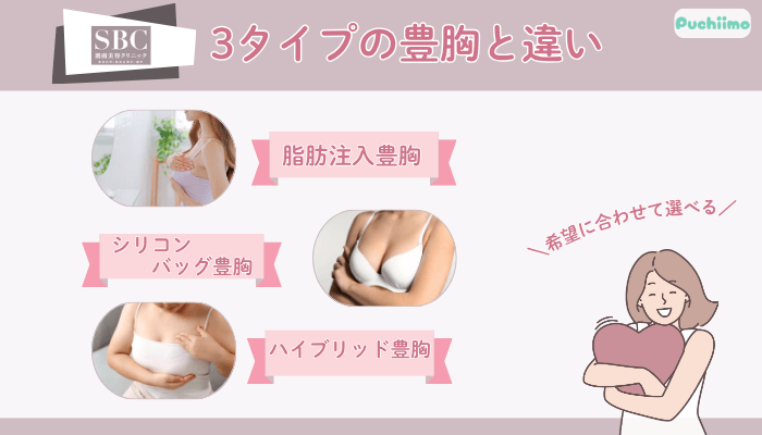 SBC3タイプの豊胸と違い