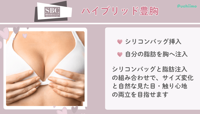 SBCハイブリッド豊胸