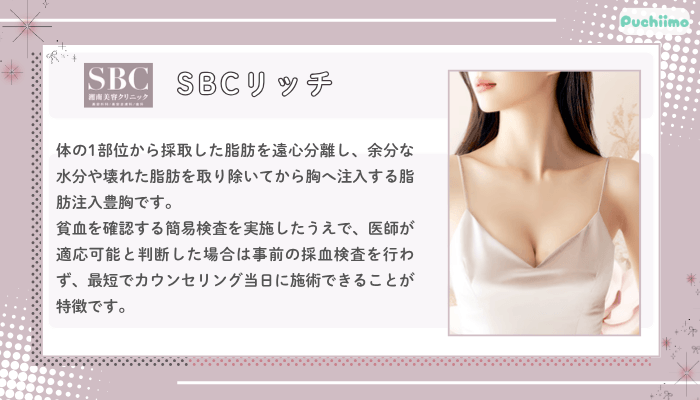 SBCリッチ