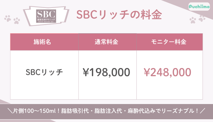 SBC豊胸SBCリッチ料金