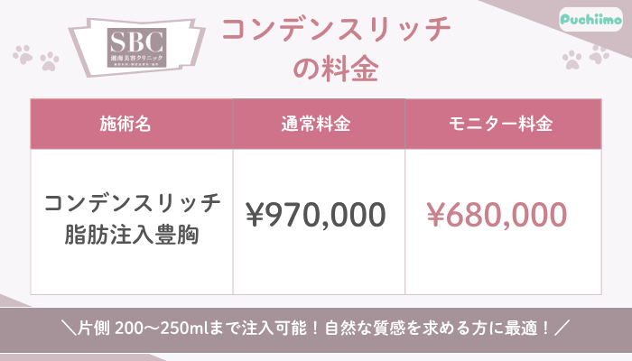 SBC豊胸コンデンスリッチ料金