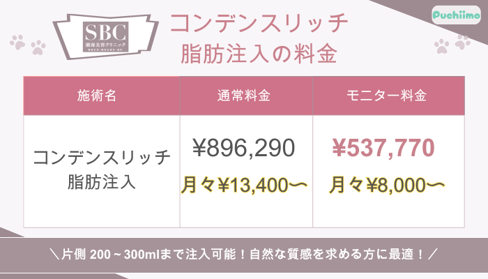 SBC豊胸コンデンスリッチ脂肪注入料金