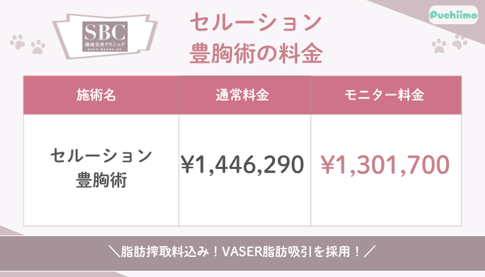 SBC豊胸セルーション豊胸術料金