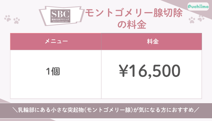 SBC豊胸モントゴメリー腺切除の料金
